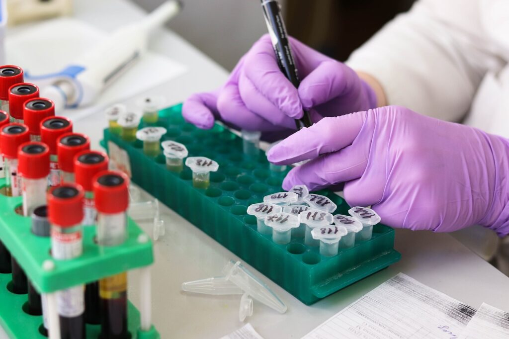 Tay-Sachs disease cord blood banking